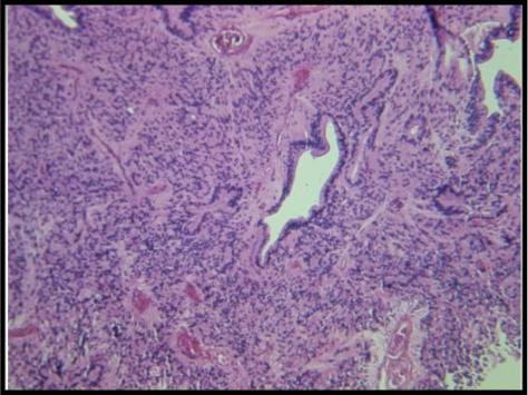 Neuropathology Set 2 Q14