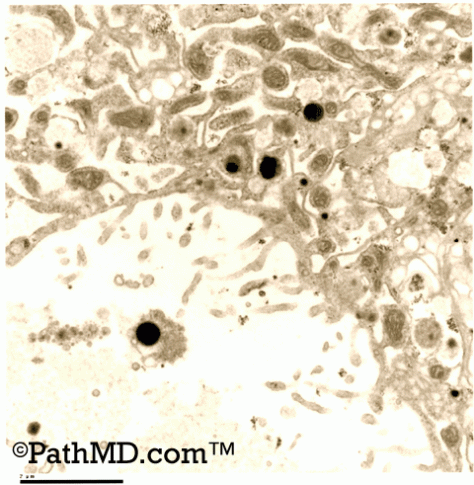 Electron Microscopy Set 1 Case 1