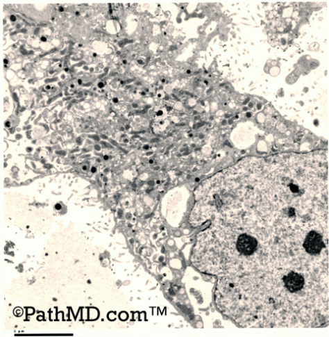 Electron Microscopy Set 1 Case 1