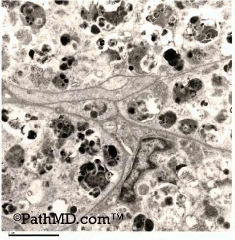 Electron Microscopy Set 1 Case 2