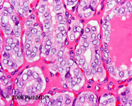 Head & Neck - Part 4, Question #2