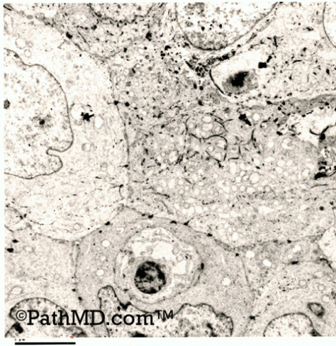 Electron Microscopy Set 1 Case 3