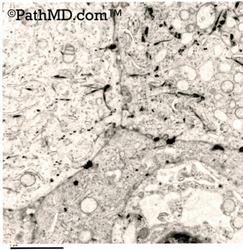 Electron Microscopy Set 1 Case 3