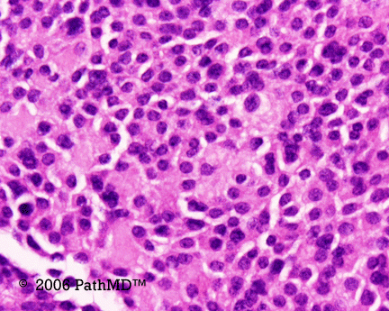 Head & Neck - Part 4, Question #3