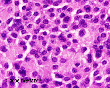 Head & Neck - Part 4, Question #3