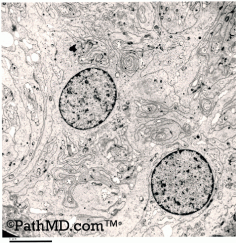 Electron Microscopy Set 1 Case 4