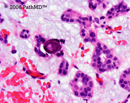 Head & Neck - Part 4, Question #4