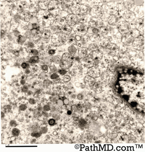 Electron Microscopy Set 1 Case 5
