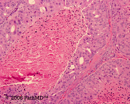 Head & Neck - Part 4, Question #5