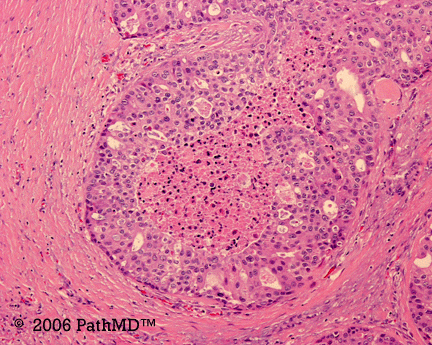 Head & Neck - Part 4, Question #5