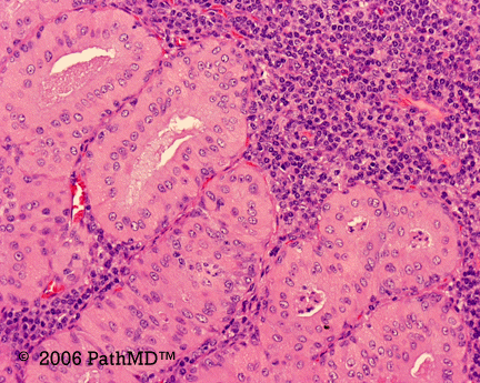 Head & Neck - Part 4, Question #6