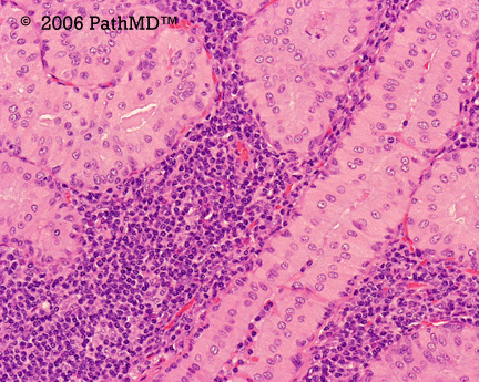 Head & Neck - Part 4, Question #6