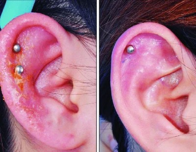 Ear piercing cost in dubai