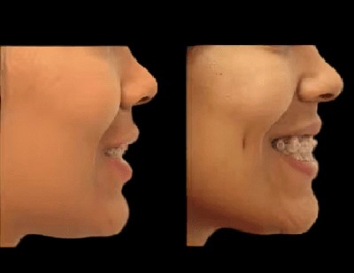 Dimple creation pictures in dubai