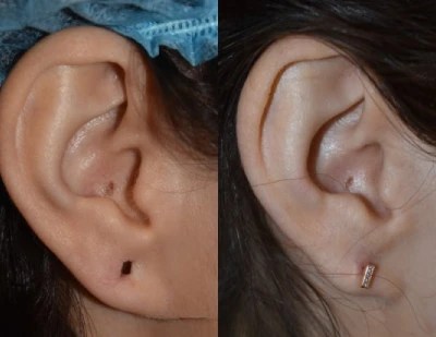 Ear piercing cost in abu dhabi