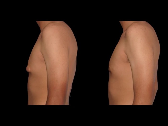 Reconstructive surgery recovery in dubai