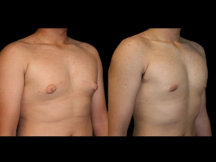 Reconstructive surgery