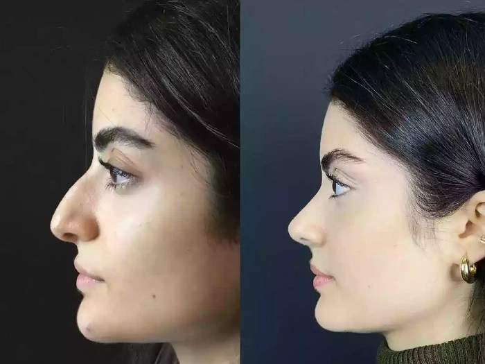 Reconstructive surgery before and after pictures