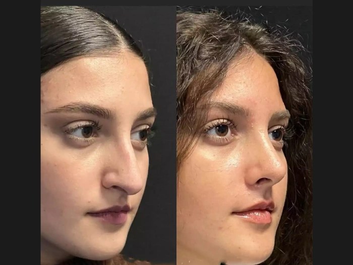 Reconstructive surgery before and after pictures