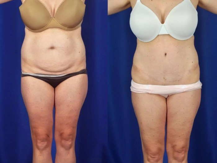 Reconstructive surgery in dubai