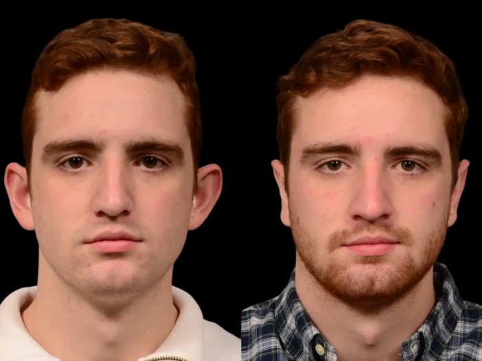 Reconstructive surgery