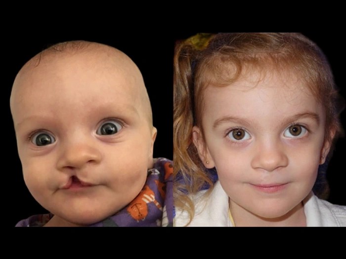 Reconstructive surgery