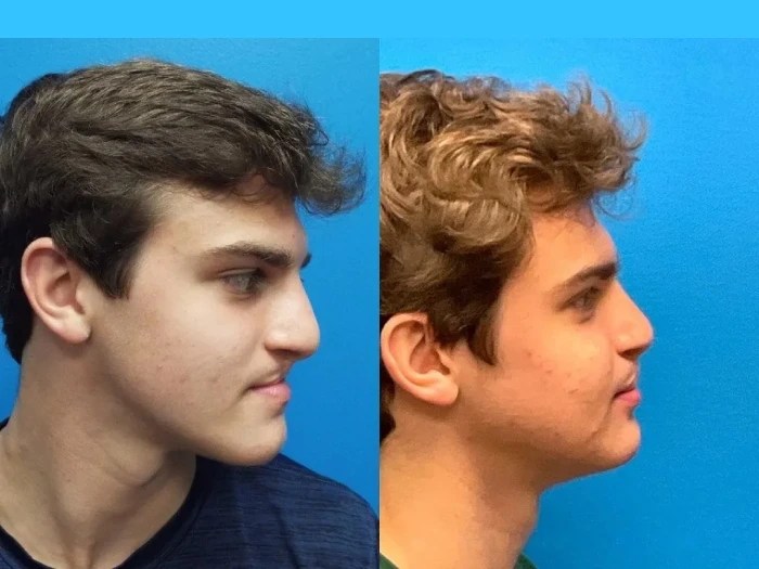 Reconstructive surgery in dubai