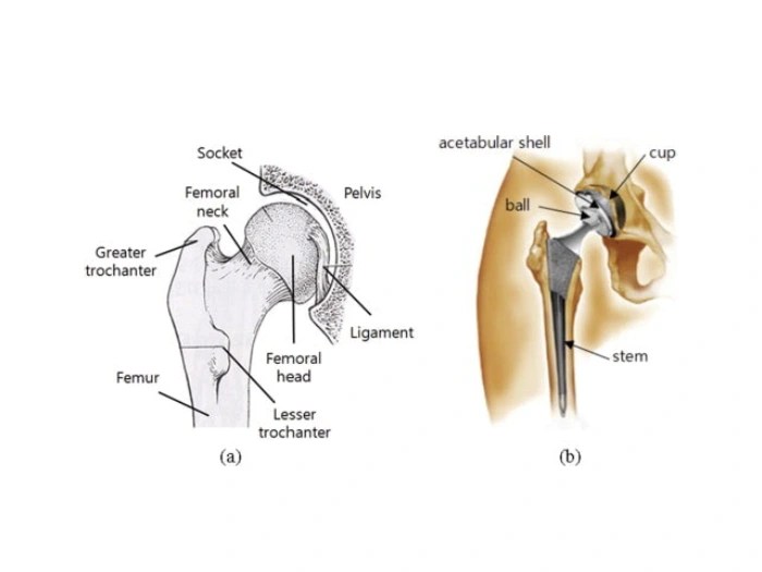 Reconstructive surgery before and after images