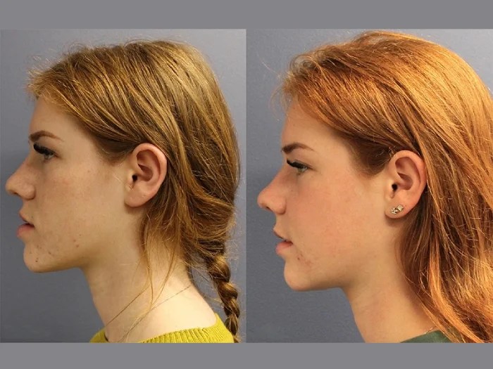 Reconstructive surgery in abu dhabi