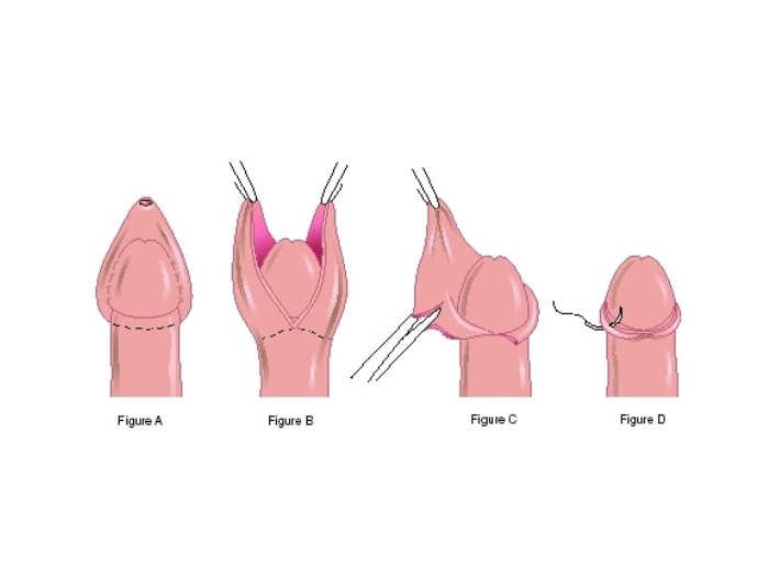 Reconstructive surgery picture uae