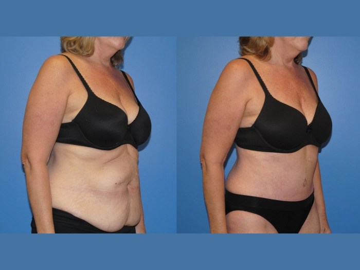 Reconstructive surgery