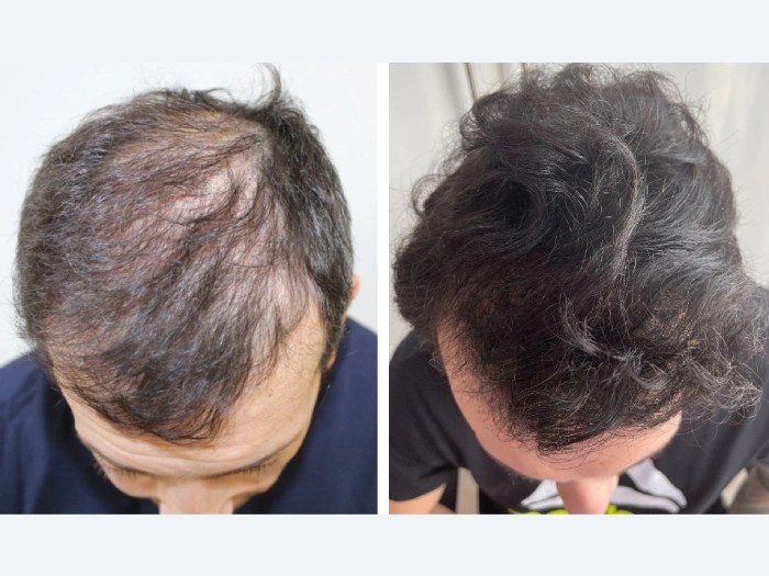 Front line hair fixing at perfect drs
