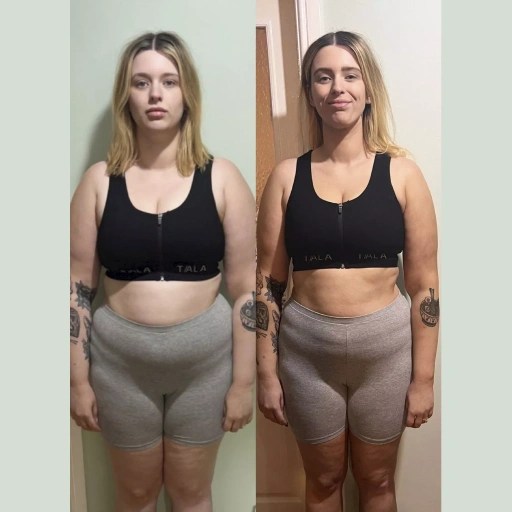 Mounjaro injection before after result
