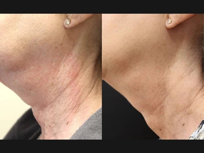 Secret Duo Before After in Abu Dhabi