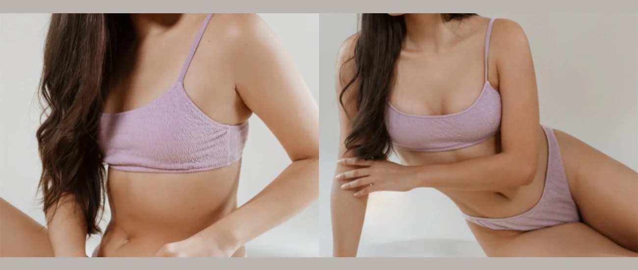 Mia femtech breast implants before after at perfect drs