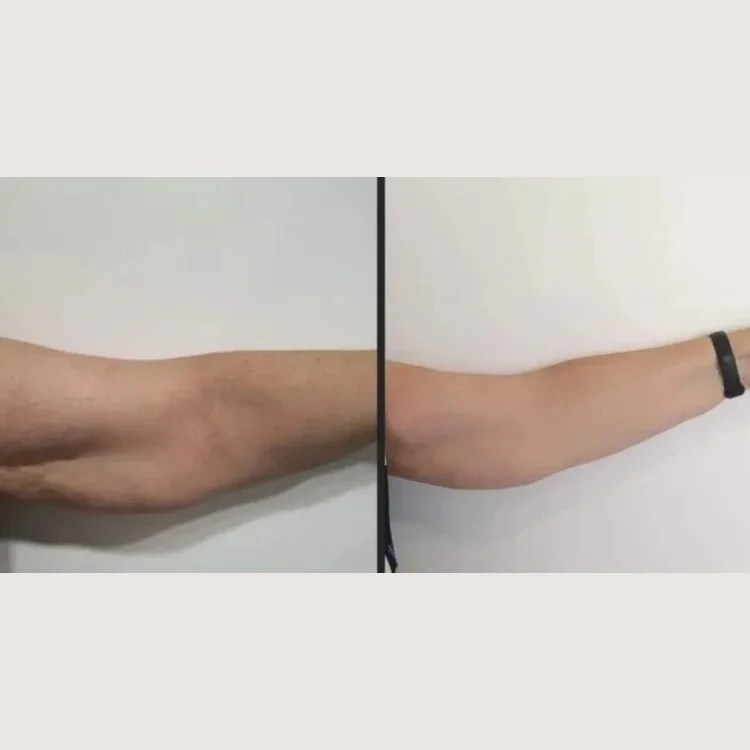 Wonder Axon Before After Uae