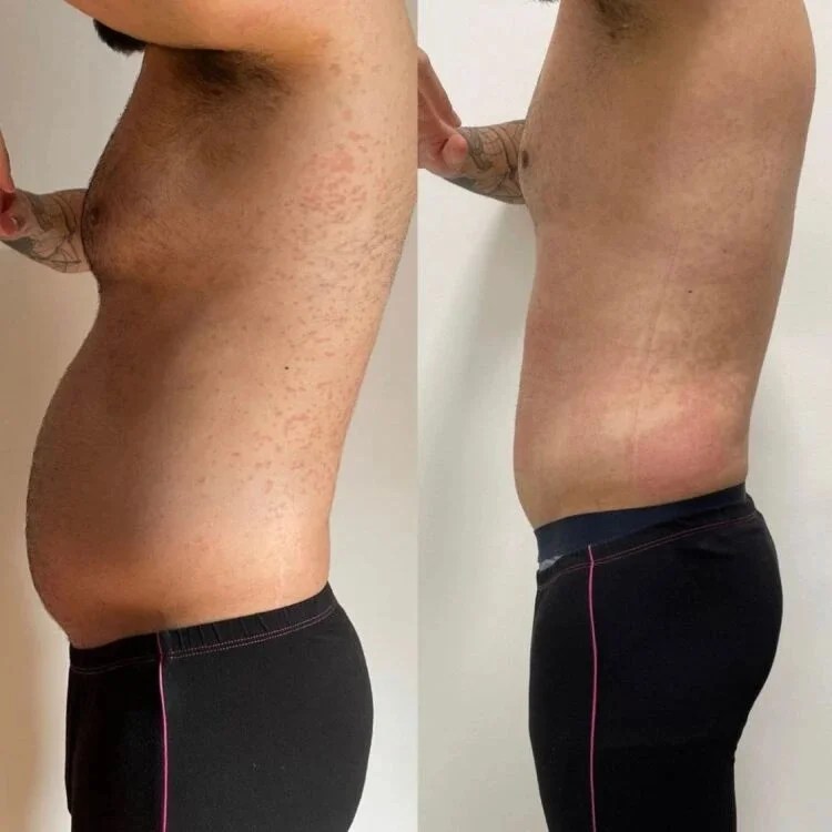 Wonder Axon Results Before and After Uae