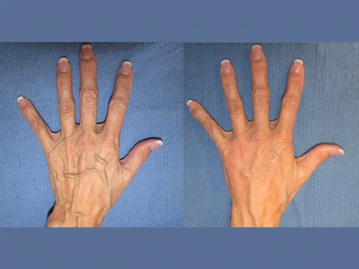 Viora St at Perfect Drs