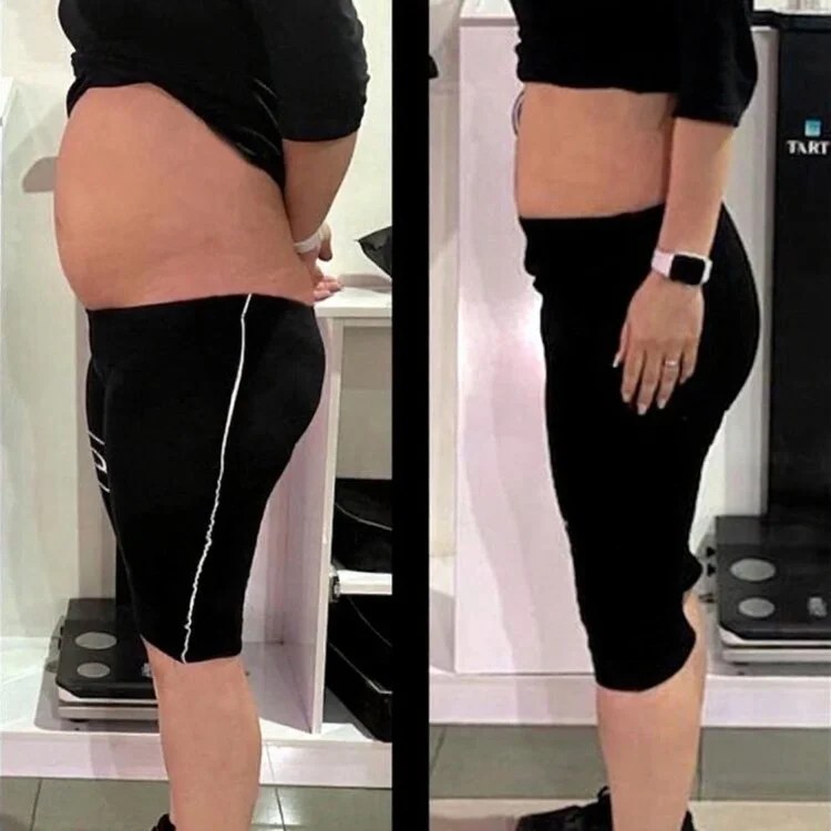 Wonder Axon Before After Results