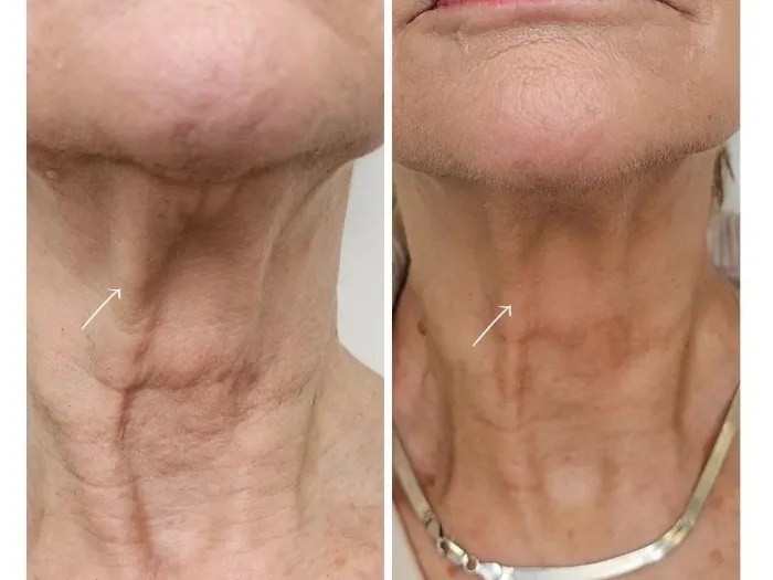 Perfect Drs Sunekos Skin Booster