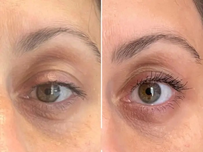 Skin boosters in dubai