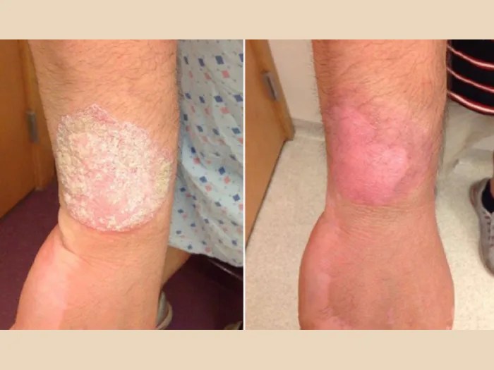 Rash Soothing and Healing at Perfect Drs