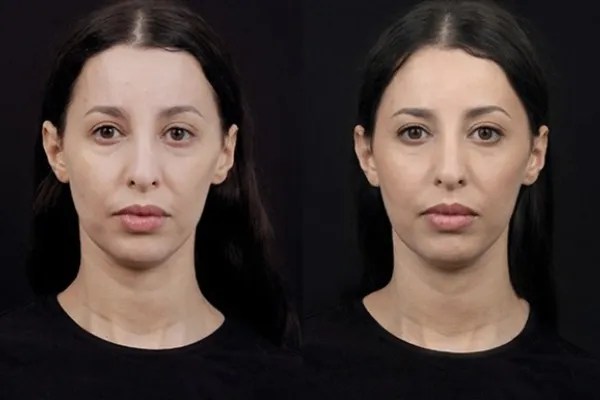 Perfect Drs Professional NCTF Skin Care