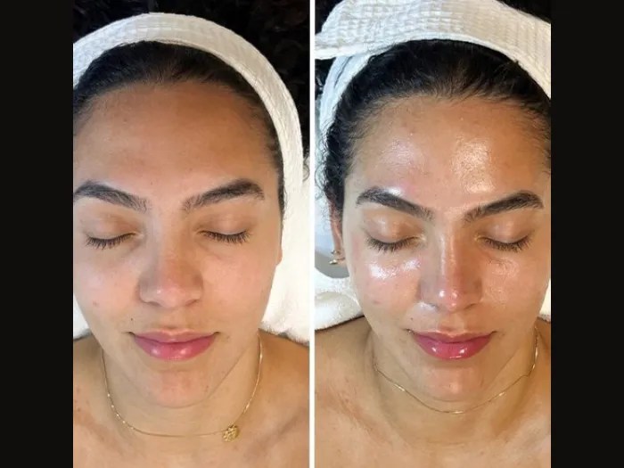 Perfect Drs Signature Red Carpet Glow Facial