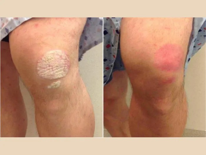 Professional Skin Rash Cure Abu Dhabi