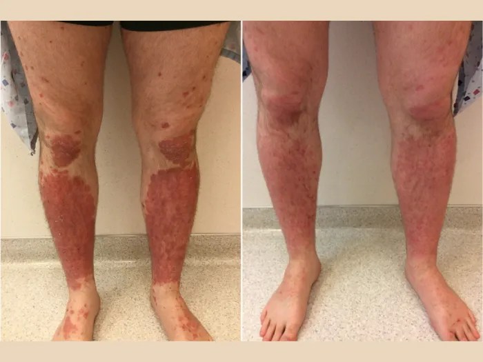 Best Skin Rash Management in Dubai