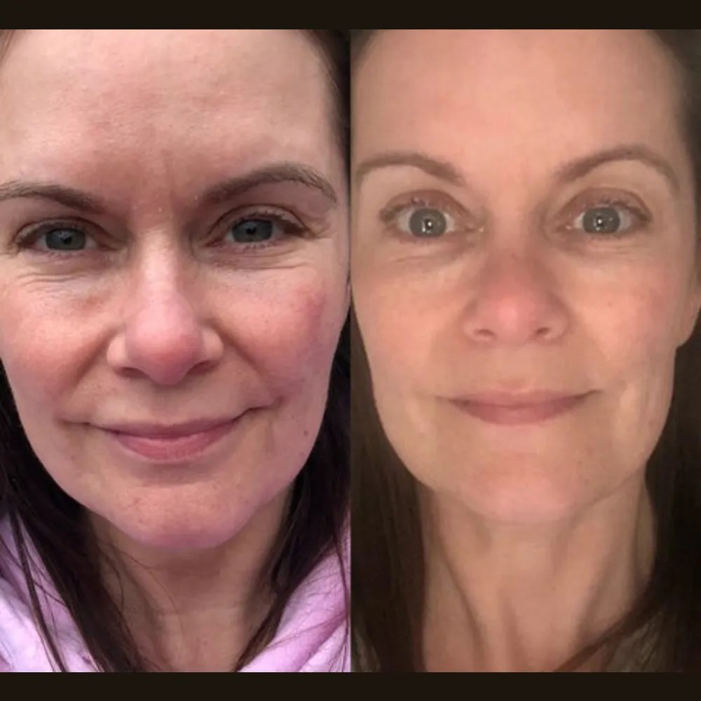 Safe Dehydrated Skin Care Solutions Dubai