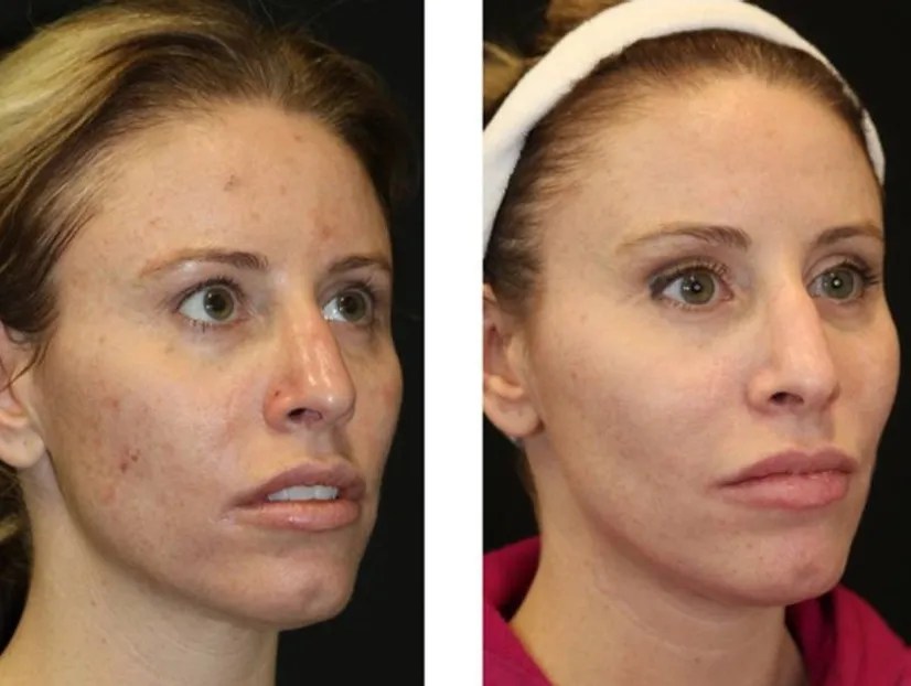 Perfect Drs SaltFacial for Glowing Skin