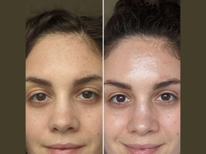 Perfect Drs Filorga NCTF for Hydration and Glow