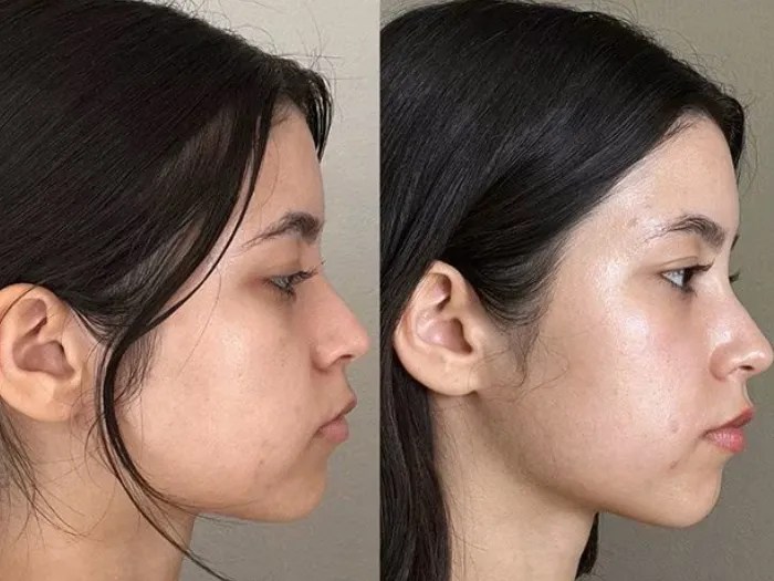 Advanced Red Carpet Facial Therapy Abu Dhabi